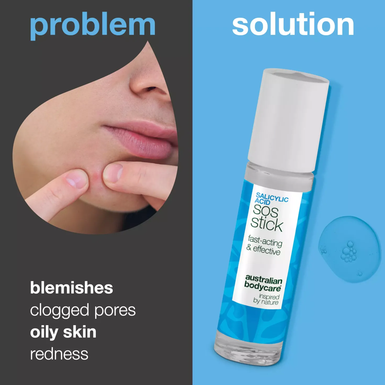 Australian Bodycare Salicylic Acid Sos Stick 9 ml