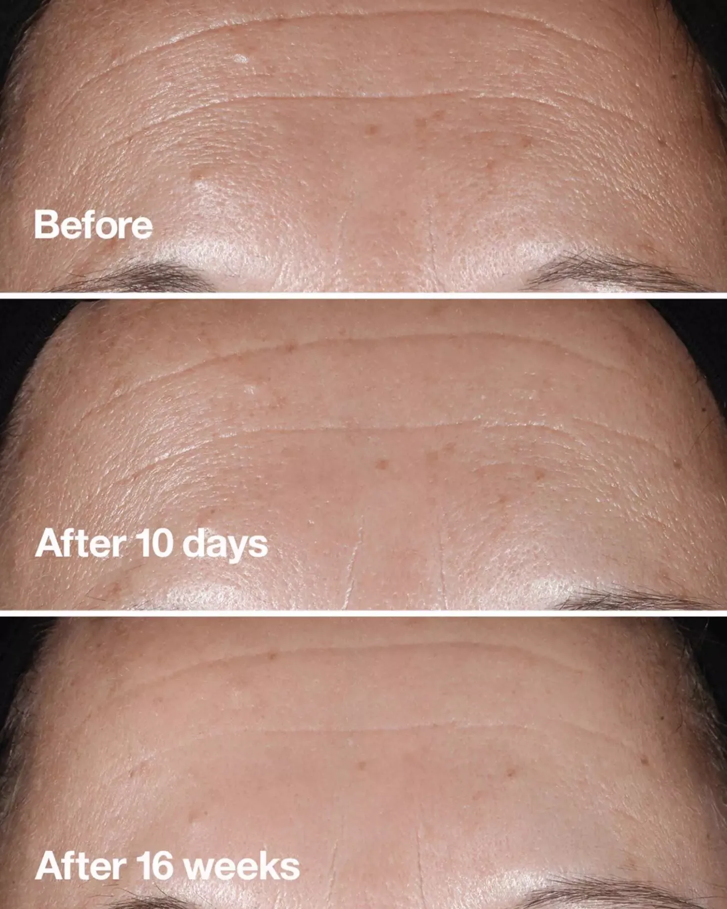 CliniqueSmart Clinical Repair Clinical Repair Wrinkle Correcting Serum 50 ml