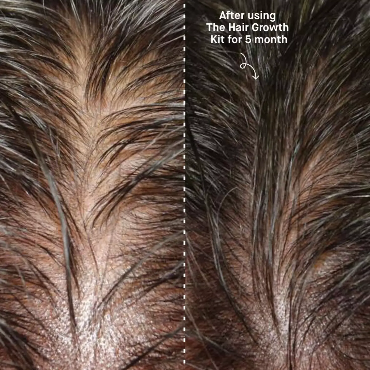 Copenhagen GroomingHair The Hair Growth Kit