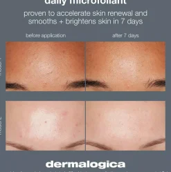 DermalogicaDynamic Skin Sculptor 150 ml