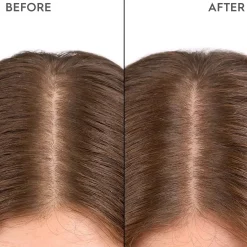 KerasilkSPECIALISTS Moisturizing Scalp Drops 100 ml